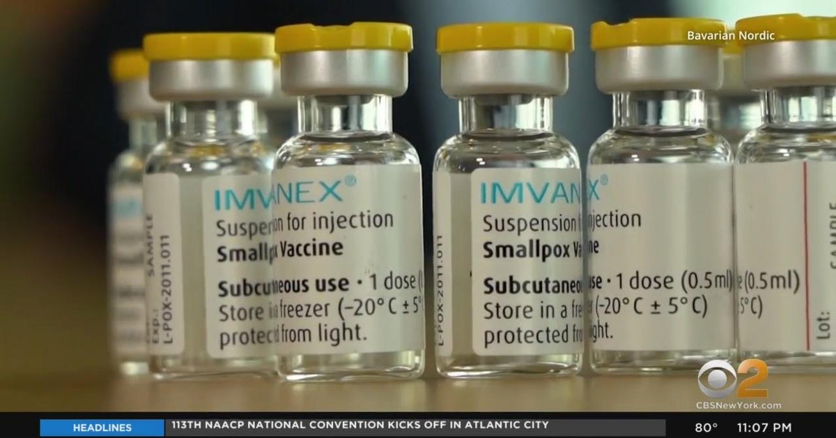 New York City to open mass monkeypox vaccination sites - CBS New York