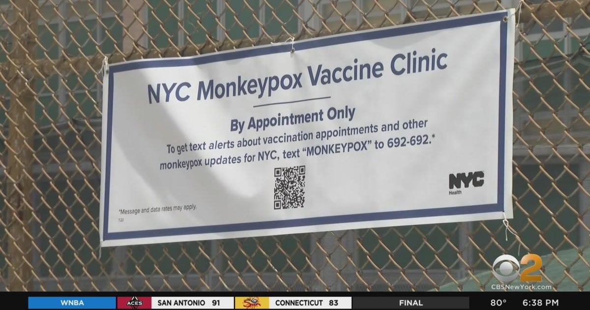 New York City opens pop-up monkeypox vaccination clinics - CBS New York