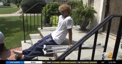 16yearold speaks out about Fire Island shark attack CBS New York