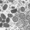 U.S. confirms first two cases of monkeypox in children