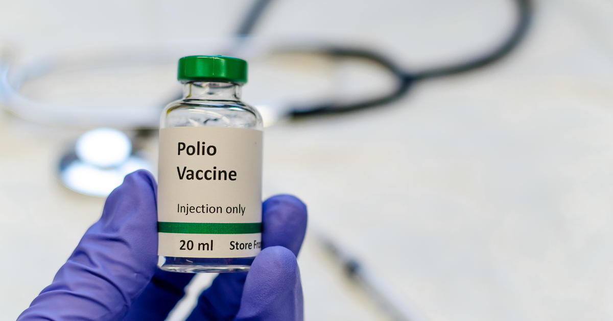 Polio detected in New York City's wastewater, suggesting virus is circulating: "Alarming, but not surprising"