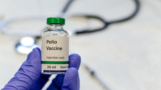 Polio vaccine vial holding in doctors hand 