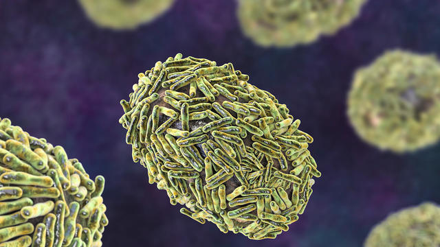 Monkeypox virus particles, illustration 