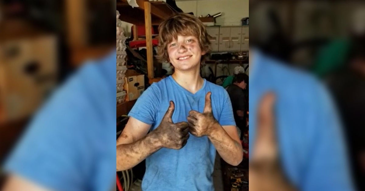 Florida teen fighting to stay alive after being infected by rare brain-eating amoeba