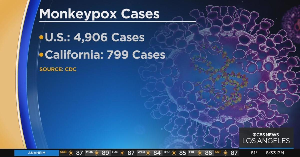 Is monkeypox more manageable for medical experts than COVID19 CBS