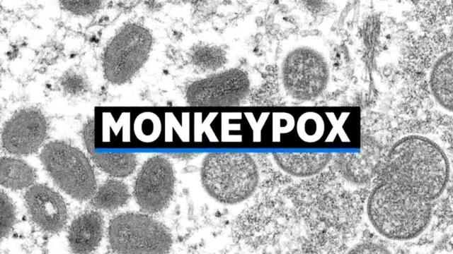 monkeypox-graphic.jpg 