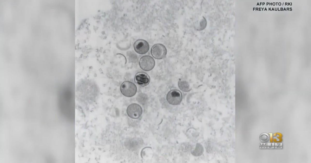 Monkeypox cases are slowly growing in Maryland CBS Baltimore