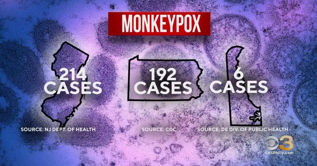 NJ health officials say monkeypox outbreak happening at worst time