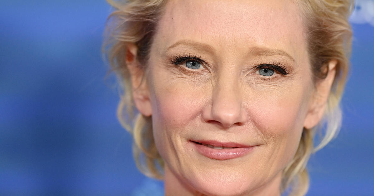 Actress Anne Heche hospitalized after car collision at LA home, catches fire