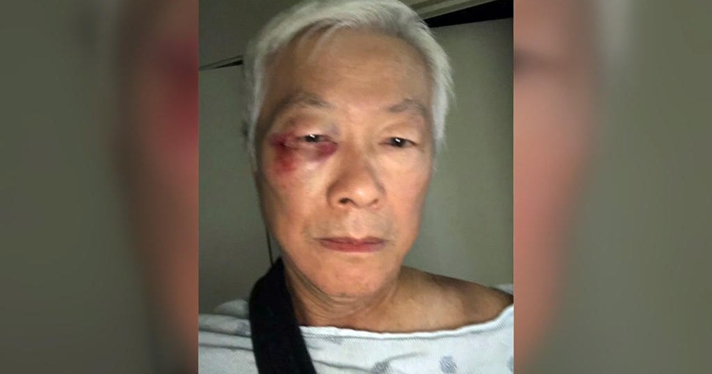 Police arrest suspect in assault of Asian S.F. community leader - CBS ...