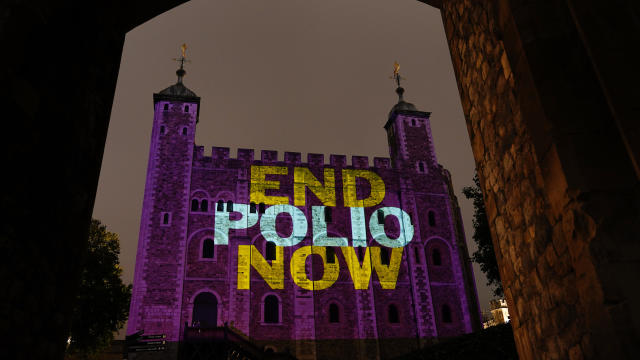 World Polio Day 