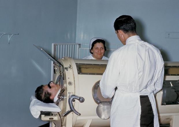 Patient in an "iron lung" respirator in 1960 