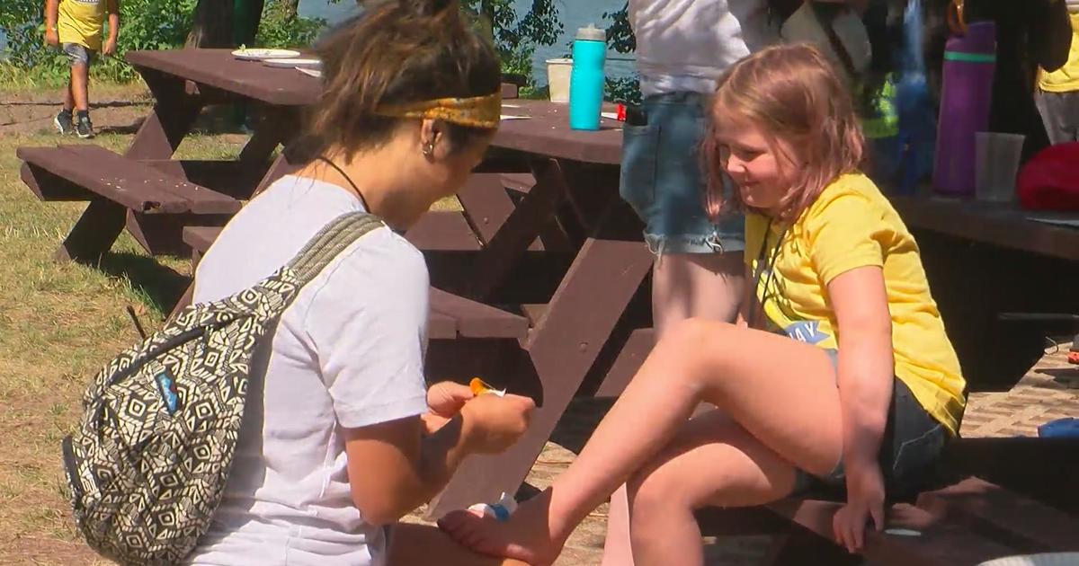 Camp Breakaway is game changer for children battling disease CBS