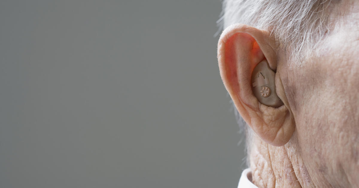 FDA moves to allow many Americans to buy hearing aids without a prescription