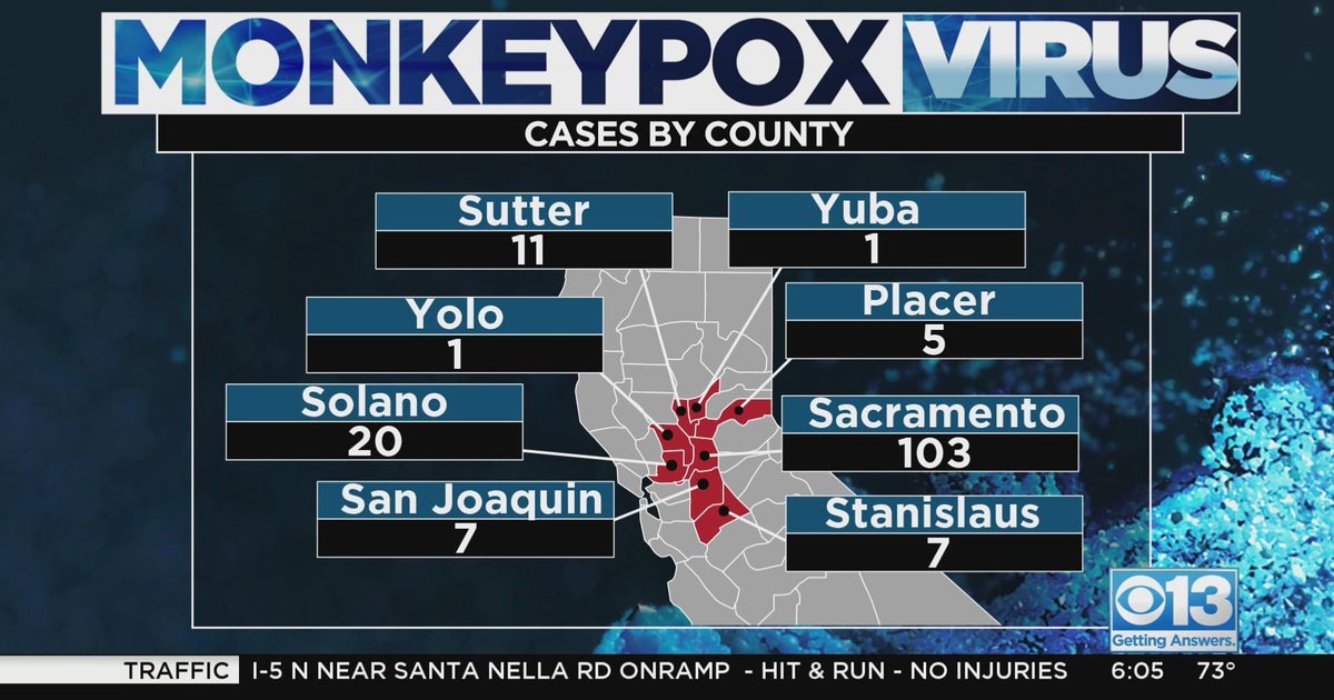Yolo County reports its first case of the monkeypox virus