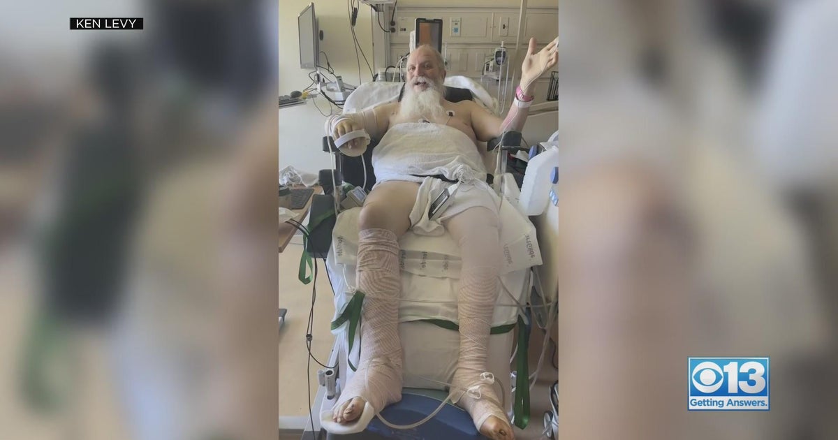 Doctors perform rare skin grafting to help Acampo man heal