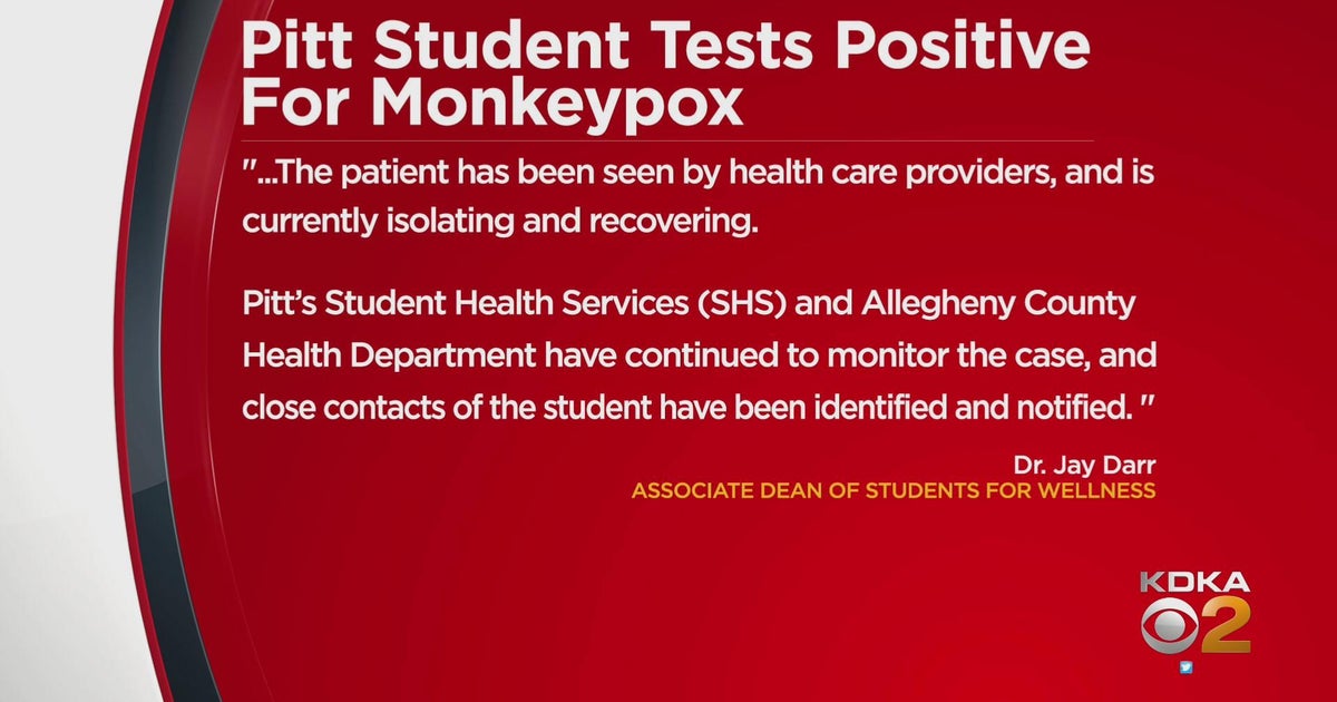 Pitt student tests positive for monkeypox CBS Pittsburgh