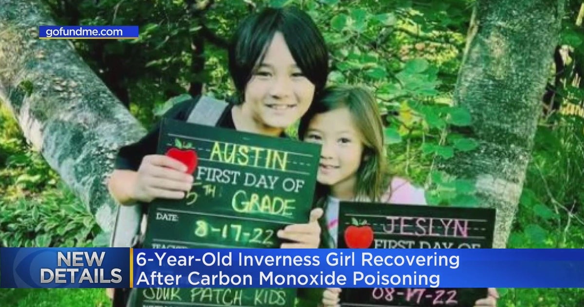 6-year-old Inverness girl recovering after carbon monoxide poisoning