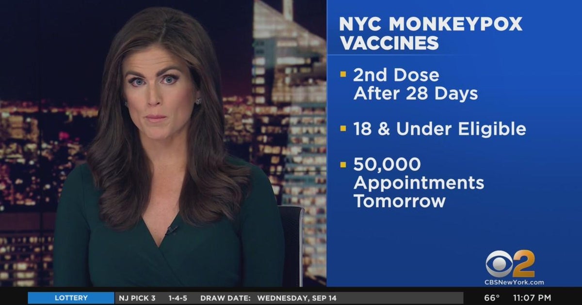 New York City expanding monkeypox vaccine eligibility - CBS New York