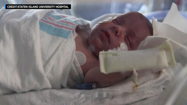 A newborn baby at the Staten Island University Hospital neonatal care unit. 
