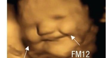 Fetuses apparently like carrots, but kale? Not so much, ultrasounds show