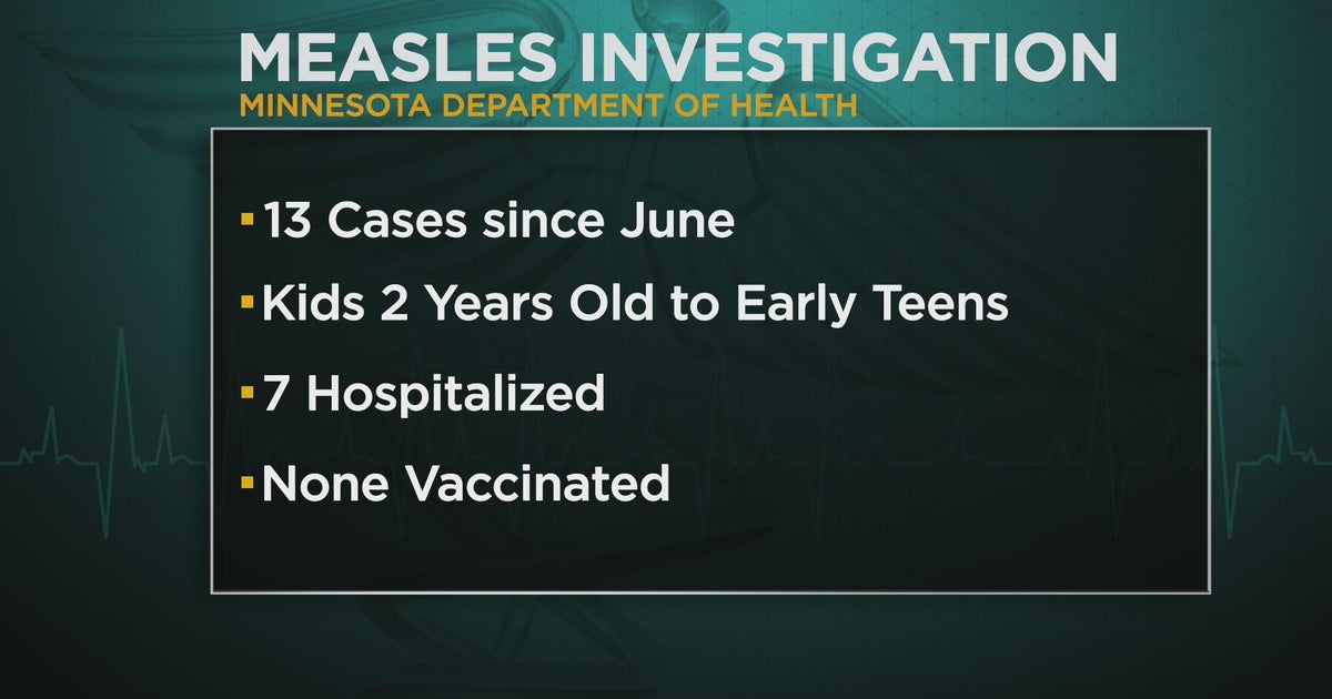 Measles cases on the rise in Minnesota CBS Minnesota