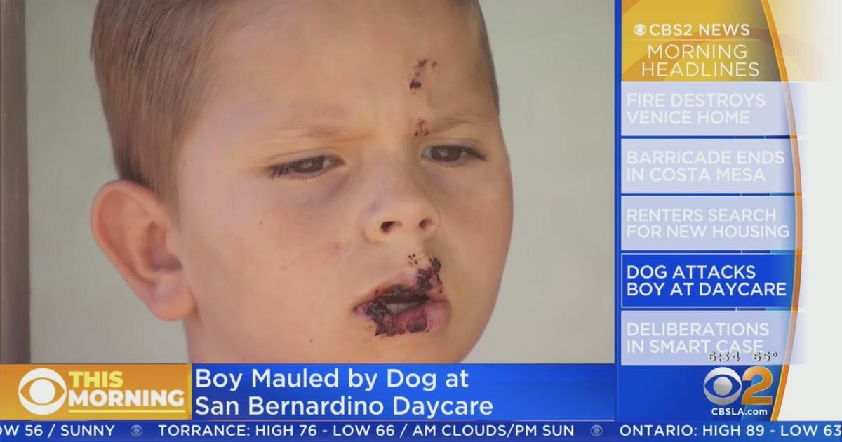 Boy severely injured in dog attack at San Bernardino daycare - CBS Los ...