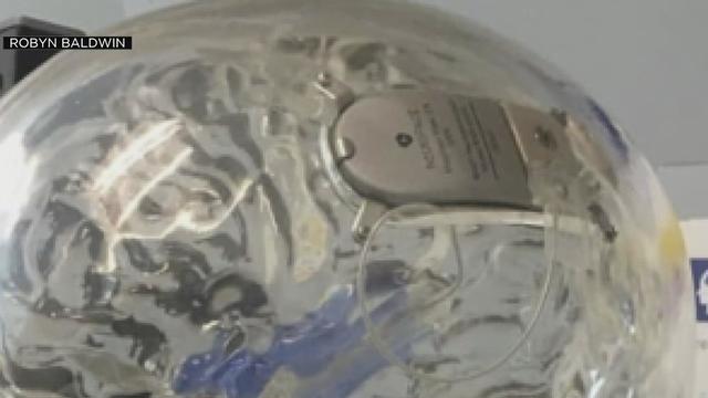 cravings brain implant 