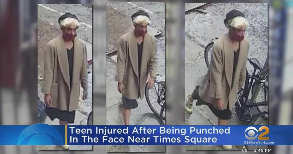 Teen punched in the face in apparently random attack CBS New York