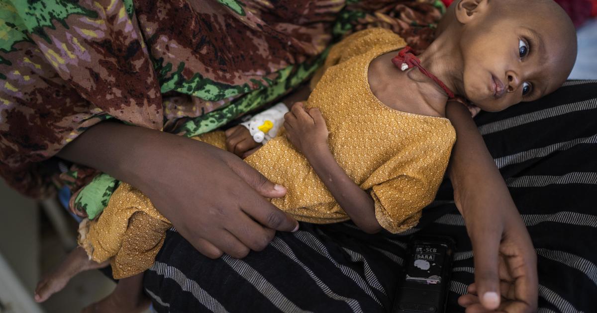 With ‘one child a minute’ hospitalized, UN warns ‘it will be too late’ if world waits to help Somalia