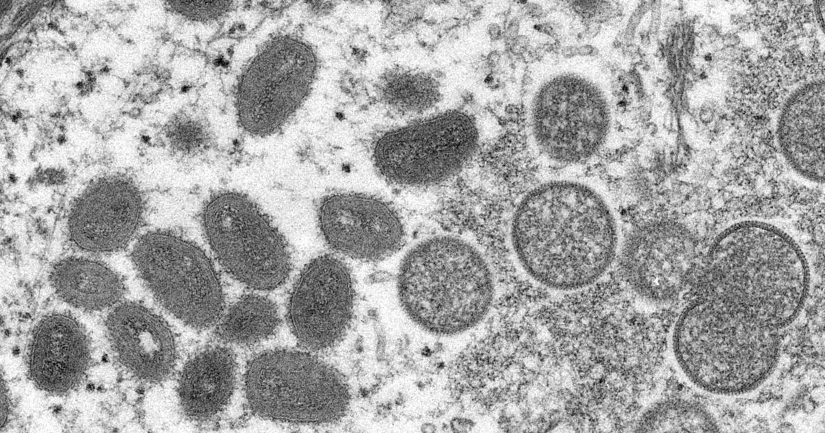 CDC investigates possible resurgence of mpox amid dozens of new cases nationwide