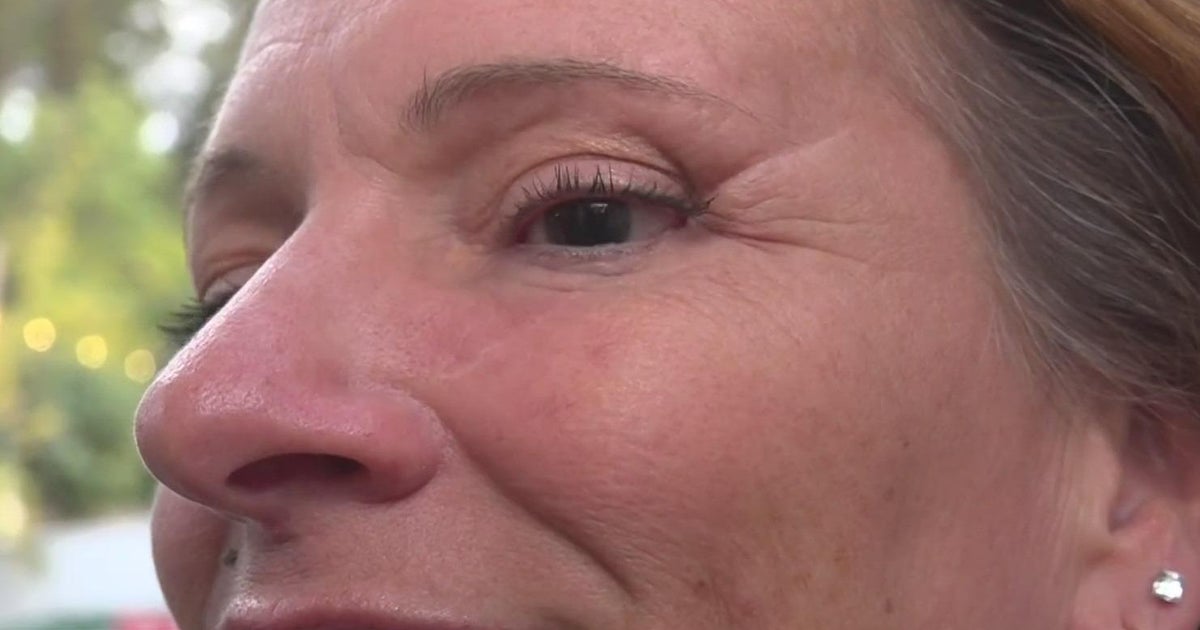 Woman who loses sight in 1 eye after Halloween hatchet attack finds closure