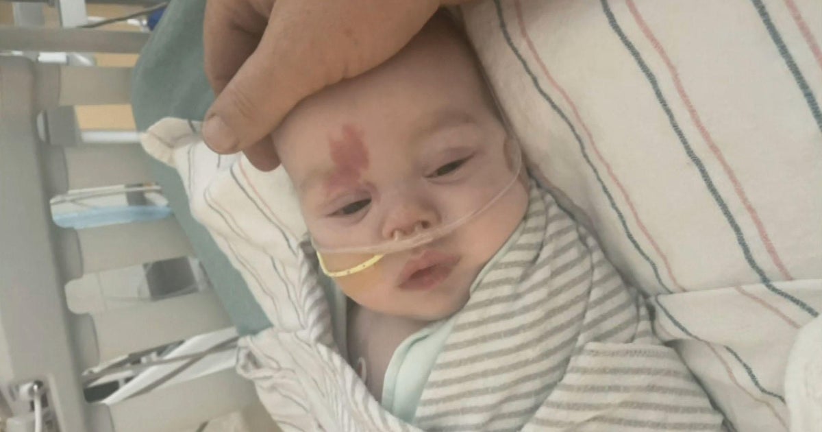 'He couldn't breathe,' Father of 4monthold with RSV details scary(02)