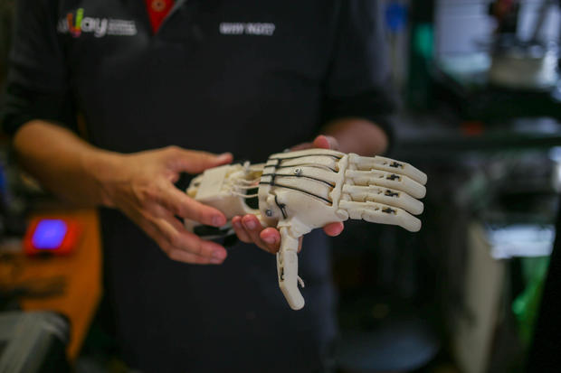Colombian company uses the 3D printer to produce prostheses for disabled children 