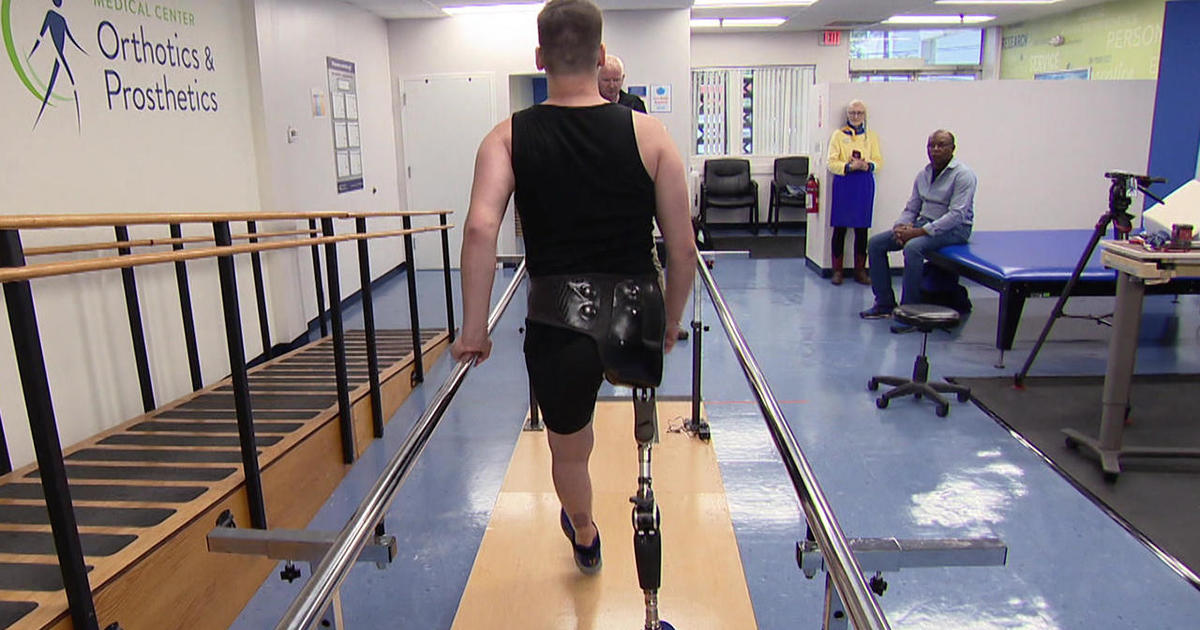 Helping a wounded Ukrainian soldier walk again