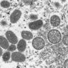 CDC microscopic image shows monkeypox virus particles 