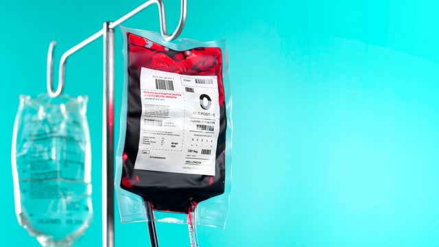 IV blood bag and saline drip on hospital stand 