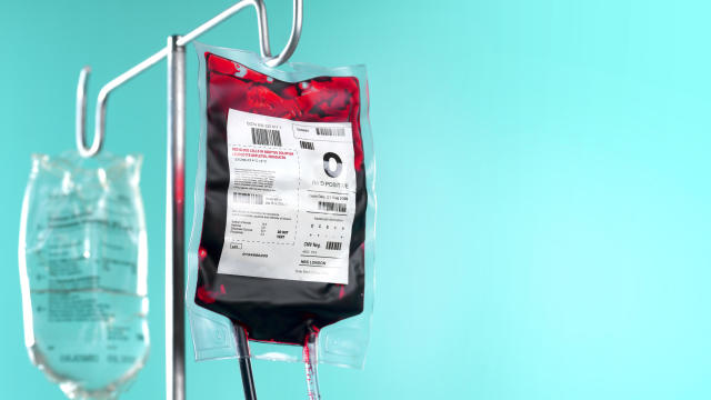 IV blood bag and saline drip on hospital stand 
