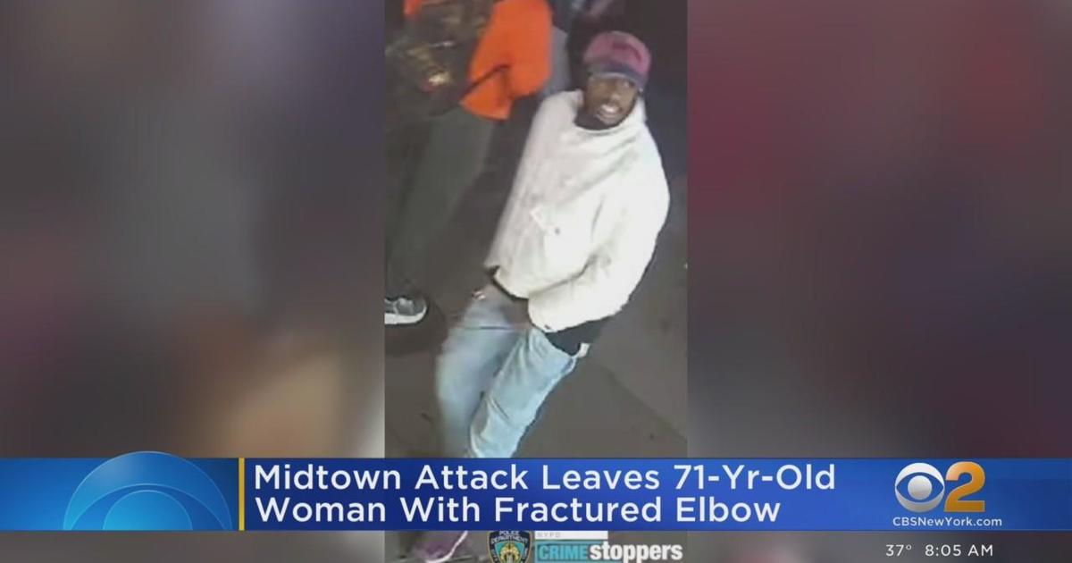 Midtown Attack Leaves 71 Year Old Woman With Fractured Elbow Cbs New York 5288