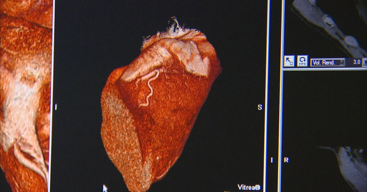 Here's an Injury Timeline for Damar Hamlin Since Suffering Cardiac Arrest –  NBC 5 Dallas-Fort Worth