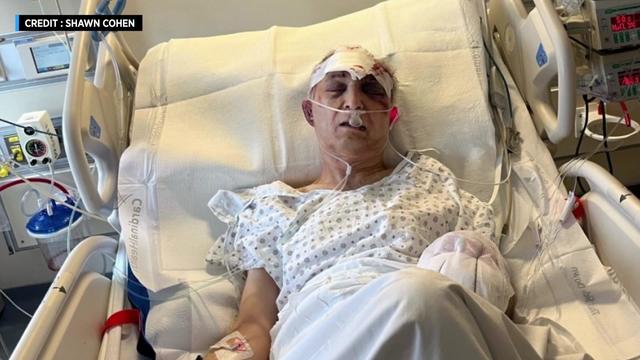 Manny Cohen lies in a hospital bed with bandages around his head. 