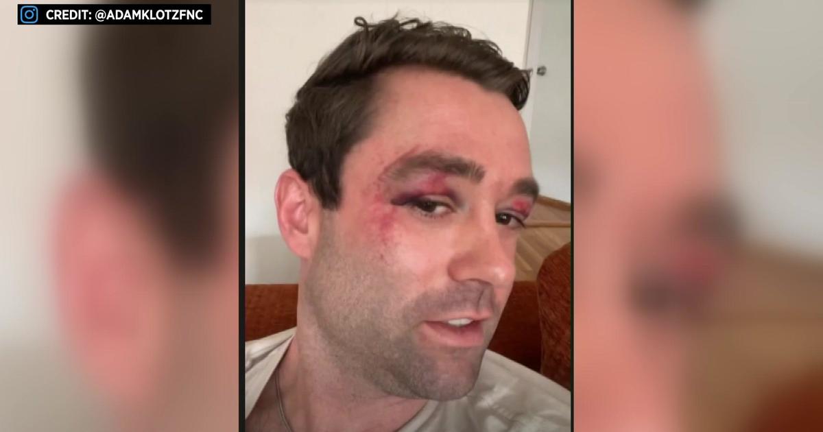 Fox News meteorologist Adam Klotz says he was attacked on New York City subway by a group of teens
