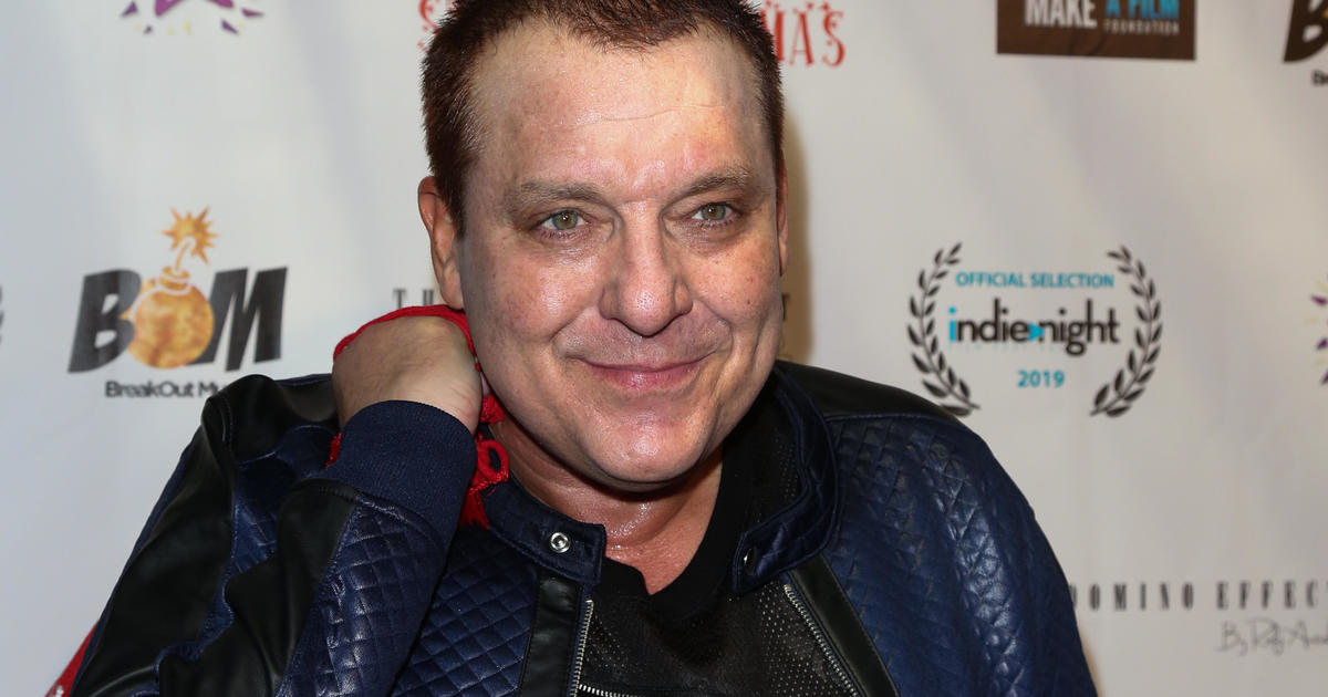 Actor Tom Sizemore in critical condition due to brain aneurysm – CBS Los Angeles