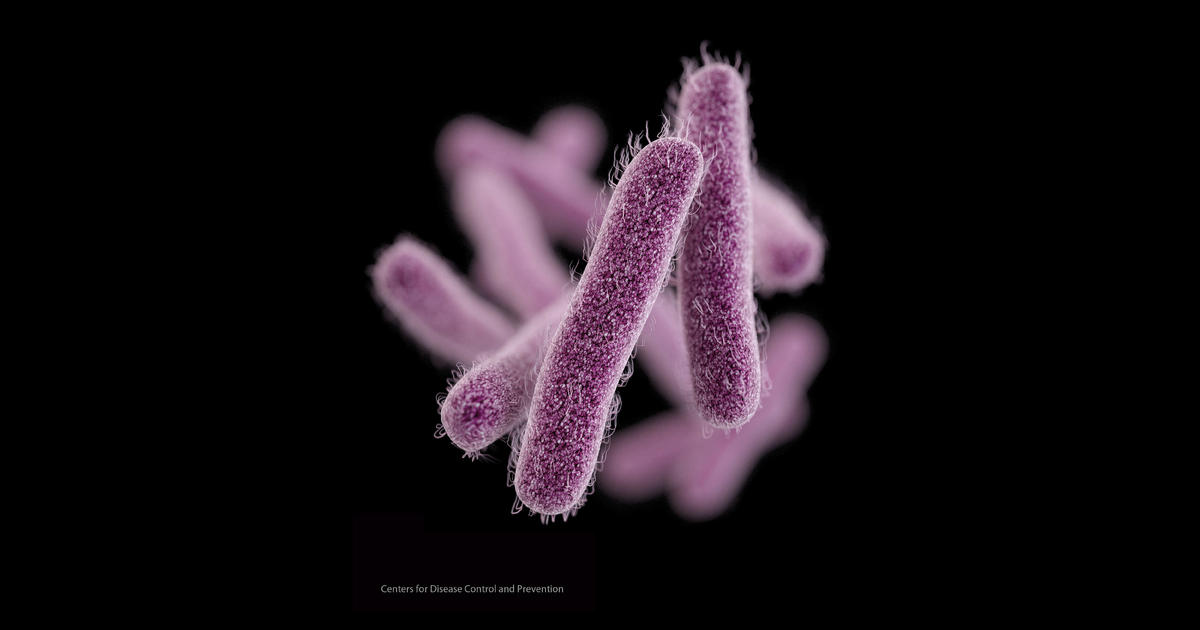 What to know about Shigella bacteria as drug-resistant strain spreads