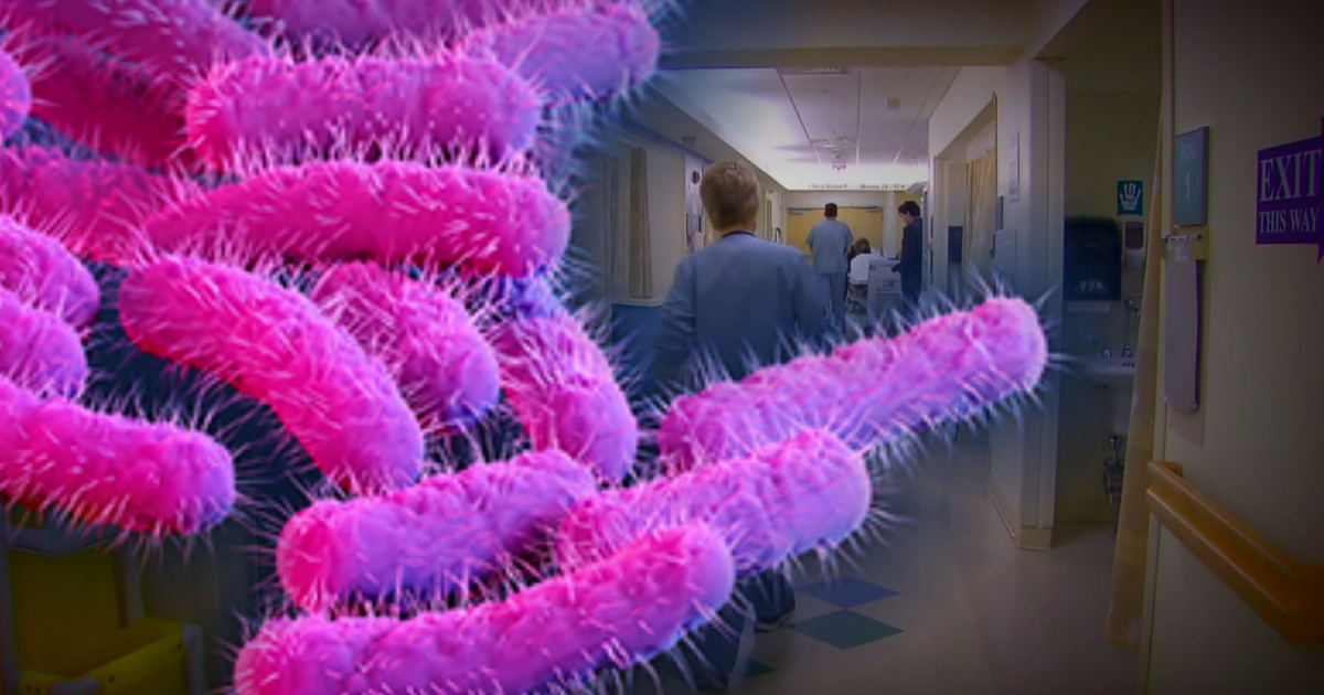 Doctors raise alarm about drugresistant Shigella bacteria CBS Chicago