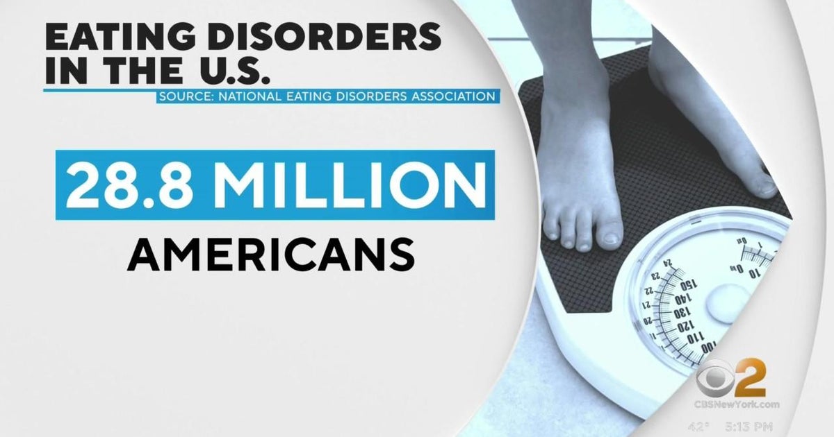 Renfrew Center helps New Yorkers struggling with eating disorders CBS