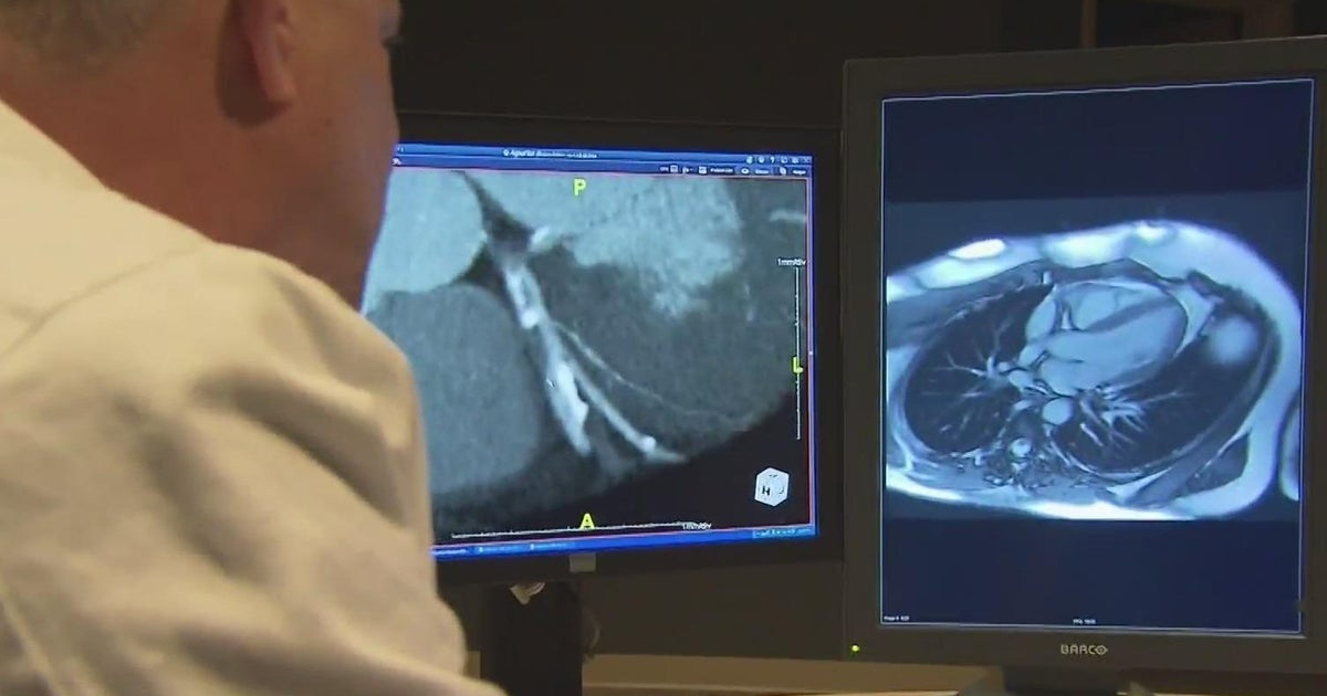 Elite athletes with genetic heart disease may continue competing