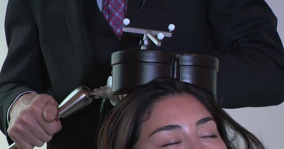 Transcranial magnetic stimulation therapy offers aid for some suffering from psychological wellness woes
