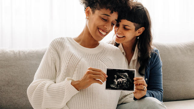 Same-sex pregnant couple holding up their ultrasound scan 
