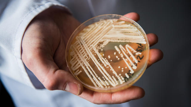 Petri dish of Candida auris fungus 
